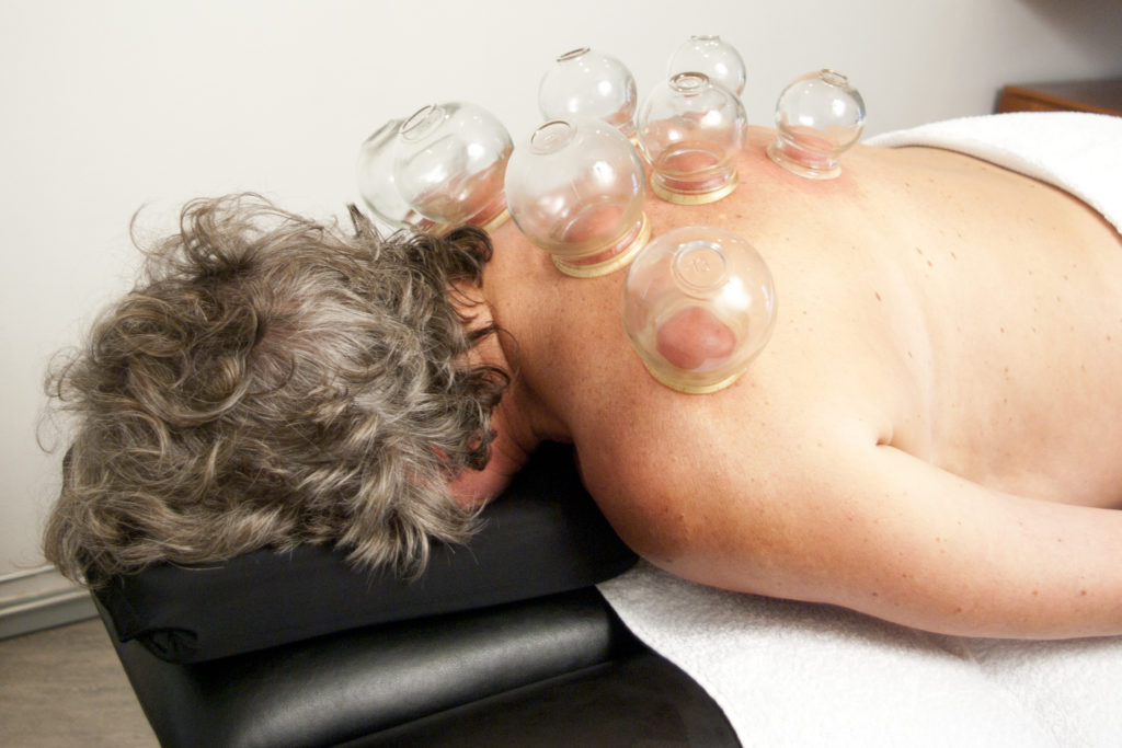 Cupping shiatsu massage Utrecht